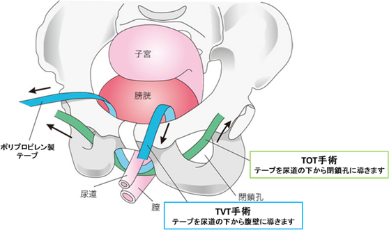 医療法人社団協友会 彩の国東大宮メディカルセンター / 泌尿器科