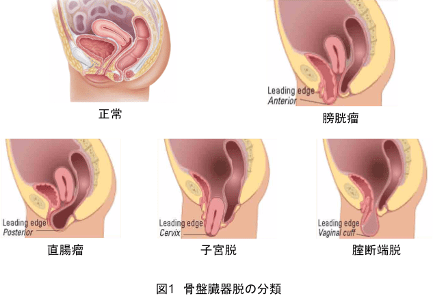 女性泌尿器外来 / 医療法人社団協友会 彩の国東大宮メディカルセンター